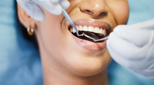 Best Urgent Care for Lost Fillings or Crowns in Williamsport, MD